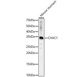 Western Blot - Anti-CHAC1 Antibody (A92420) - Antibodies.com