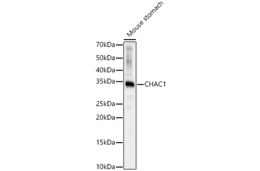 Western Blot - Anti-CHAC1 Antibody (A92420) - Antibodies.com