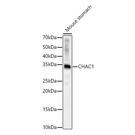 Western Blot - Anti-CHAC1 Antibody (A92420) - Antibodies.com