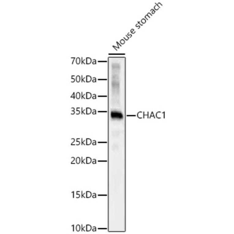 Western Blot - Anti-CHAC1 Antibody (A92420) - Antibodies.com