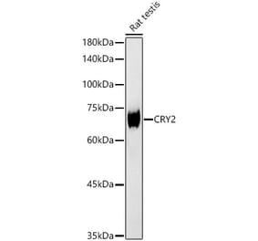 Western Blot - Anti-CRY2 Antibody (A92421) - Antibodies.com
