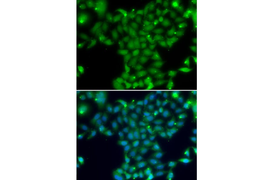 Immunofluorescence - Anti-TGM5 Antibody (A13388) - Antibodies.com