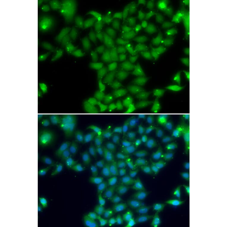 Immunofluorescence - Anti-TGM5 Antibody (A13388) - Antibodies.com
