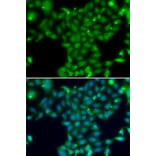 Immunofluorescence - Anti-TGM5 Antibody (A13388) - Antibodies.com