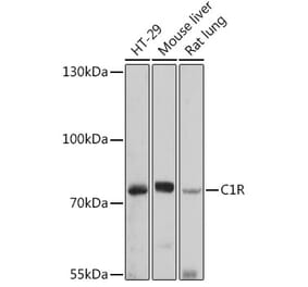 Western Blot - Anti-C1r Antibody (A92425) - Antibodies.com