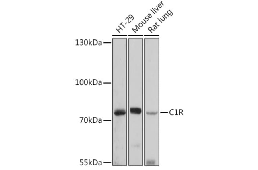 Western Blot - Anti-C1r Antibody (A92425) - Antibodies.com
