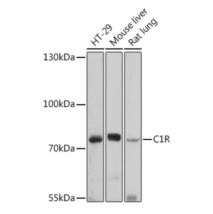 Western Blot - Anti-C1r Antibody (A92425) - Antibodies.com