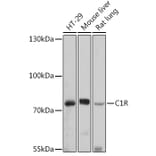 Western Blot - Anti-C1r Antibody (A92425) - Antibodies.com