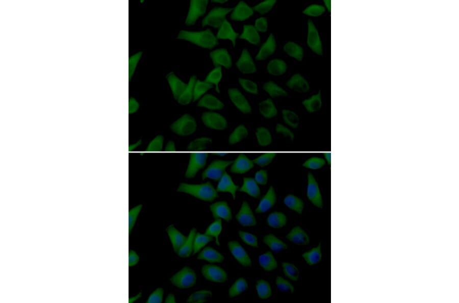 Immunofluorescence - Anti-PLOD2 Antibody (A14045) - Antibodies.com