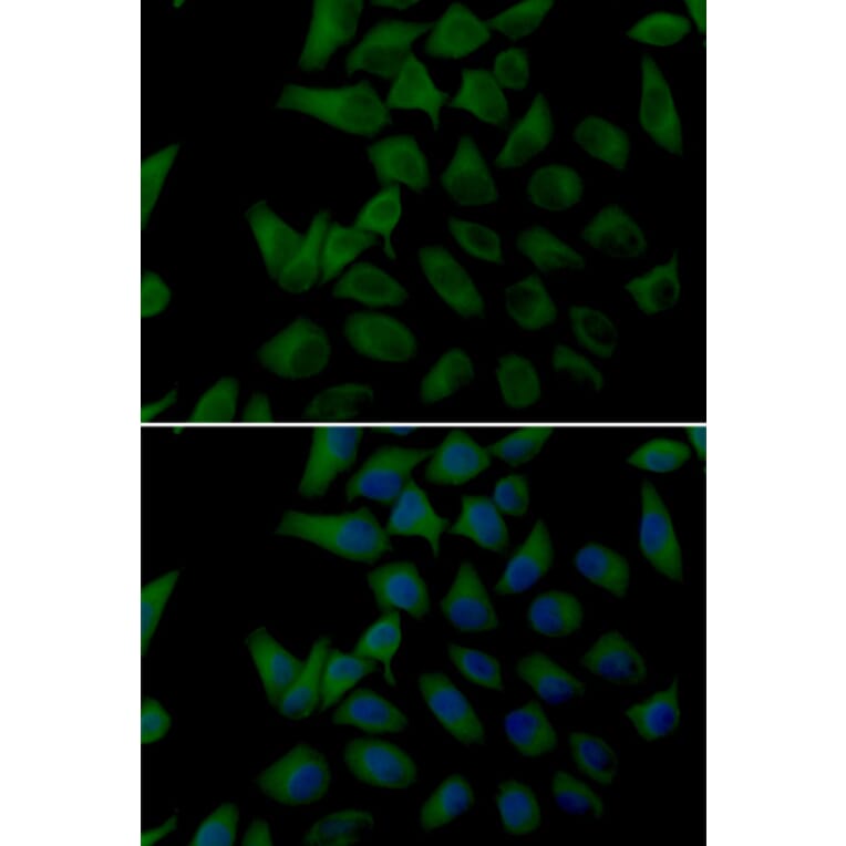 Immunofluorescence - Anti-PLOD2 Antibody (A14045) - Antibodies.com
