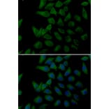Immunofluorescence - Anti-PLOD2 Antibody (A14045) - Antibodies.com