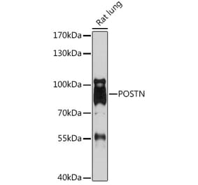Western Blot - Anti-Periostin Antibody (A92427) - Antibodies.com