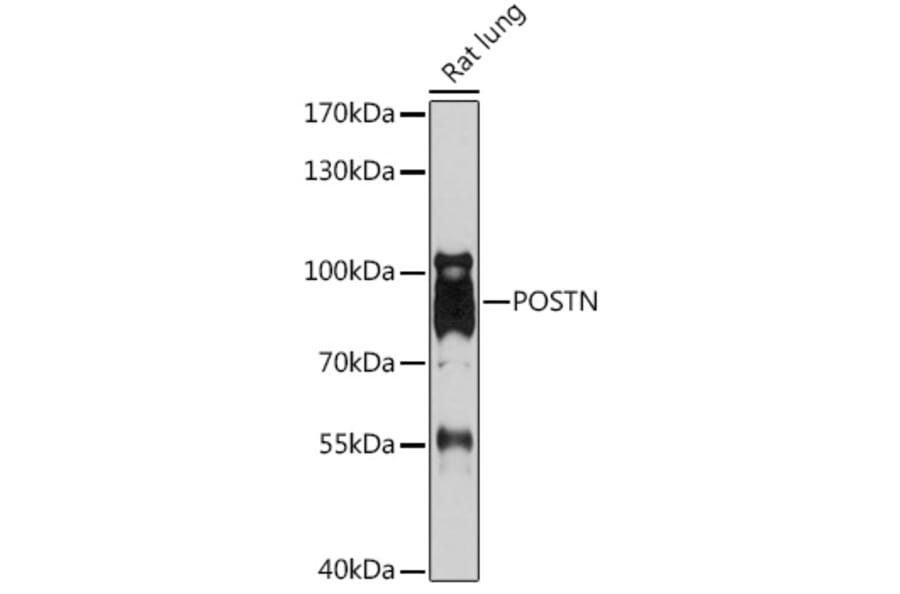 Western Blot - Anti-Periostin Antibody (A92427) - Antibodies.com