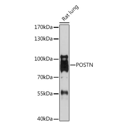 Western Blot - Anti-Periostin Antibody (A92427) - Antibodies.com