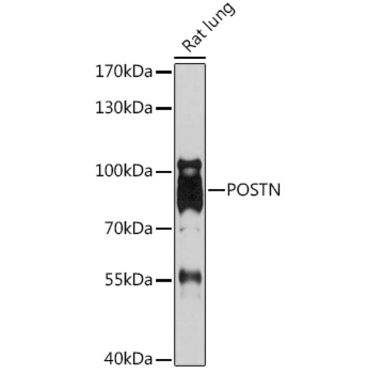 Western Blot - Anti-Periostin Antibody (A92427) - Antibodies.com