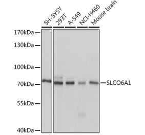 Western Blot - Anti-SLCO6A1 Antibody (A92429) - Antibodies.com