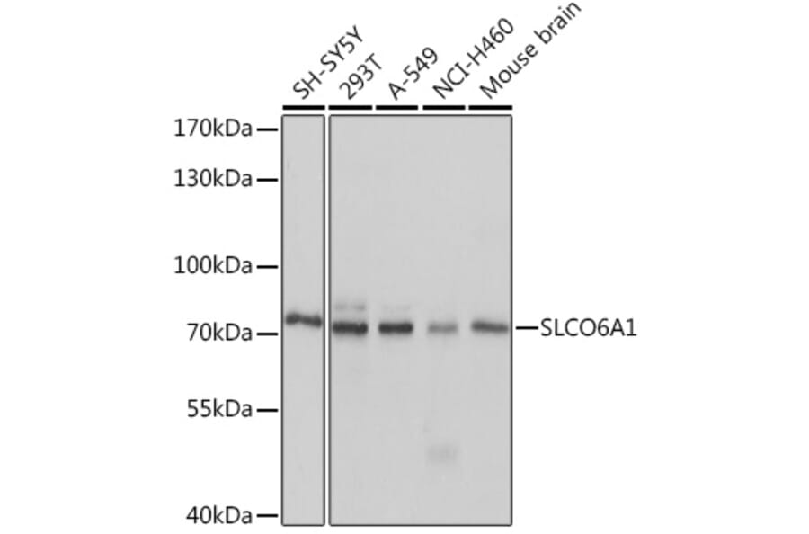 Western Blot - Anti-SLCO6A1 Antibody (A92429) - Antibodies.com