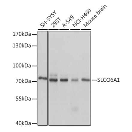 Western Blot - Anti-SLCO6A1 Antibody (A92429) - Antibodies.com