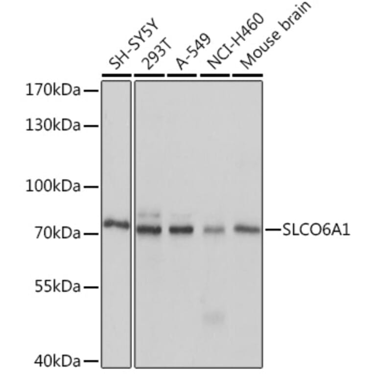 Western Blot - Anti-SLCO6A1 Antibody (A92429) - Antibodies.com