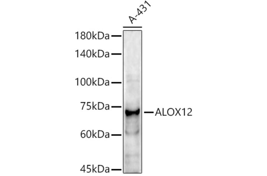 Western Blot - Anti-12 Lipoxygenase/ALOX12 Antibody (A92431) - Antibodies.com