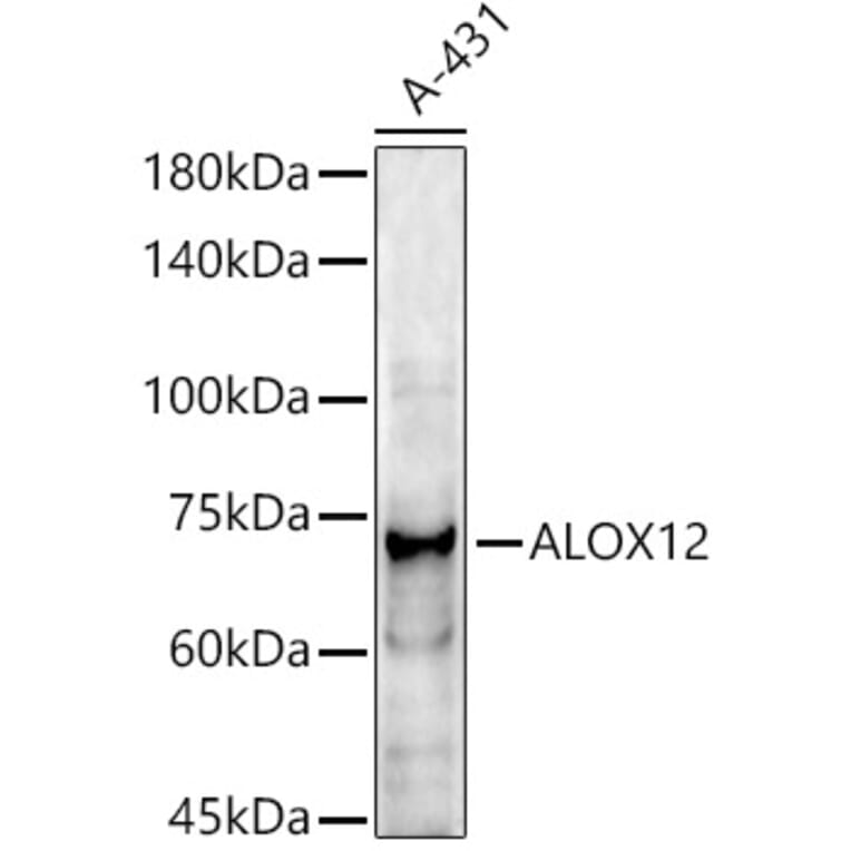 Western Blot - Anti-12 Lipoxygenase/ALOX12 Antibody (A92431) - Antibodies.com