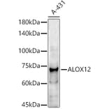 Western Blot - Anti-12 Lipoxygenase/ALOX12 Antibody (A92431) - Antibodies.com