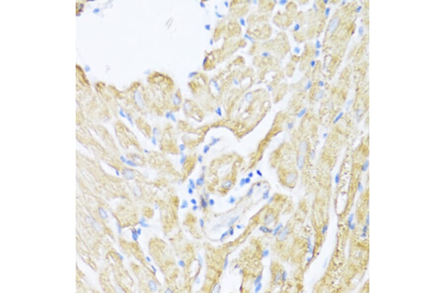 Immunohistochemistry - Anti-12 Lipoxygenase/ALOX12 Antibody (A92431) - Antibodies.com