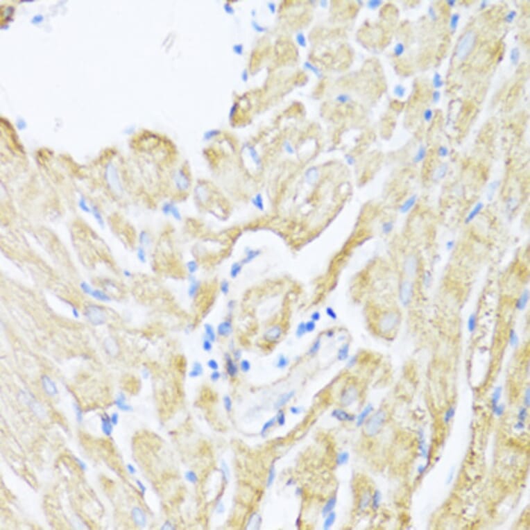 Immunohistochemistry - Anti-12 Lipoxygenase/ALOX12 Antibody (A92431) - Antibodies.com