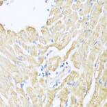 Immunohistochemistry - Anti-12 Lipoxygenase/ALOX12 Antibody (A92431) - Antibodies.com
