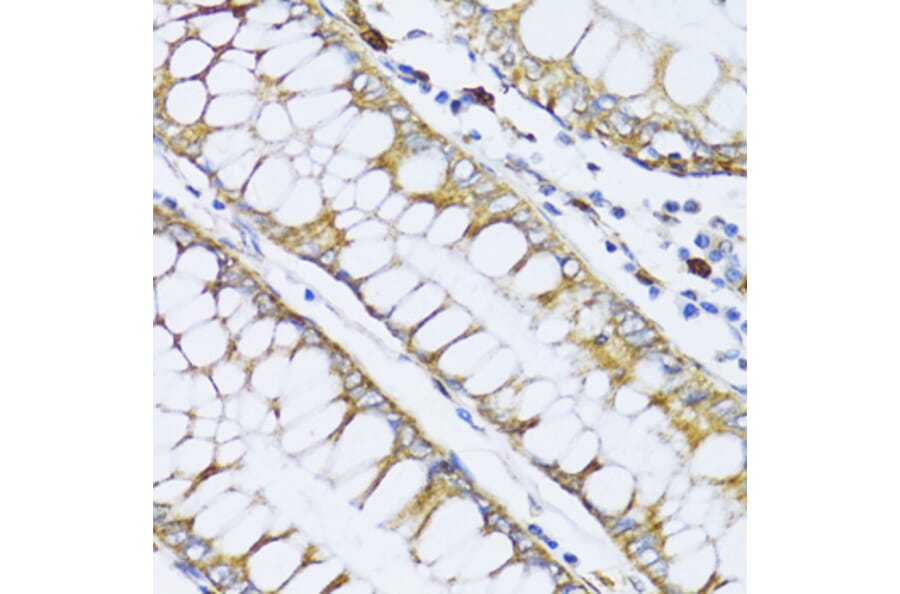 Immunohistochemistry - Anti-12 Lipoxygenase/ALOX12 Antibody (A92431) - Antibodies.com