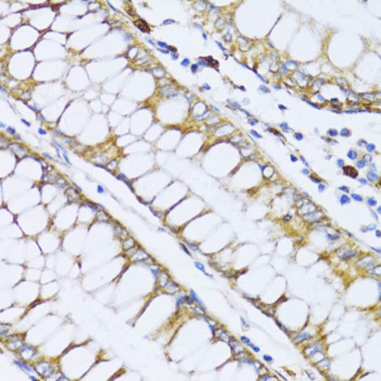 Immunohistochemistry - Anti-12 Lipoxygenase/ALOX12 Antibody (A92431) - Antibodies.com