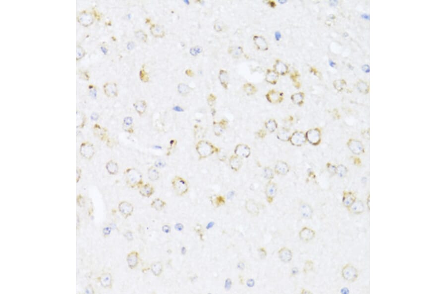 Immunohistochemistry - Anti-12 Lipoxygenase/ALOX12 Antibody (A92431) - Antibodies.com