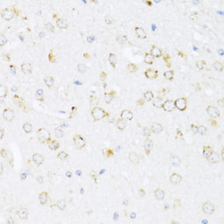 Immunohistochemistry - Anti-12 Lipoxygenase/ALOX12 Antibody (A92431) - Antibodies.com