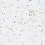 Immunohistochemistry - Anti-12 Lipoxygenase/ALOX12 Antibody (A92431) - Antibodies.com
