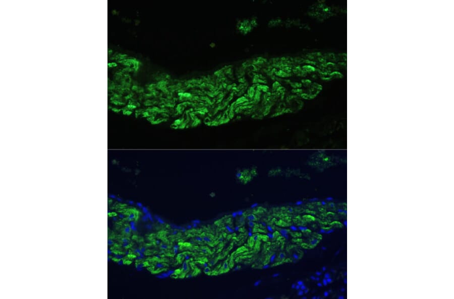 Immunofluorescence - Anti-12 Lipoxygenase/ALOX12 Antibody (A92431) - Antibodies.com