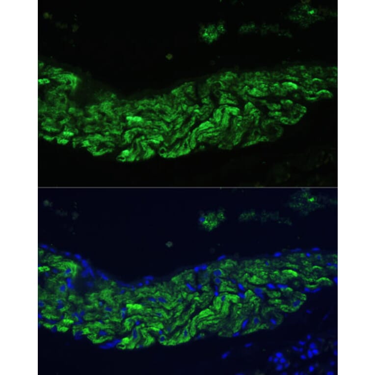 Immunofluorescence - Anti-12 Lipoxygenase/ALOX12 Antibody (A92431) - Antibodies.com
