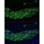 Immunofluorescence - Anti-12 Lipoxygenase/ALOX12 Antibody (A92431) - Antibodies.com