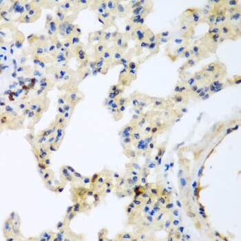 Immunohistochemistry of paraffin-embedded rat lung using Anti-LEPREL2 Antibody (A2293) at dilution of 1:200 (40x lens).