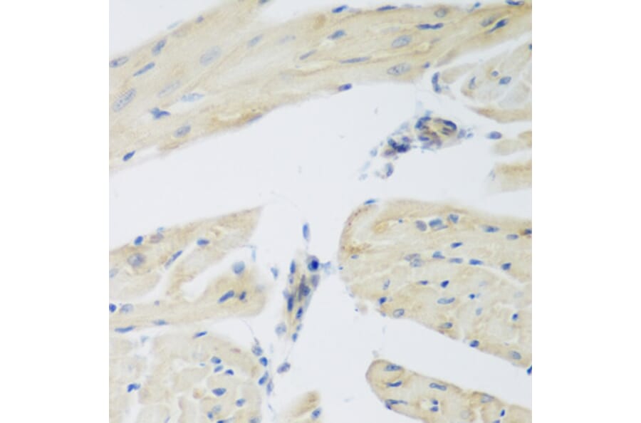 Immunohistochemistry - Anti-LEPREL2 Antibody (A2293) - Antibodies.com