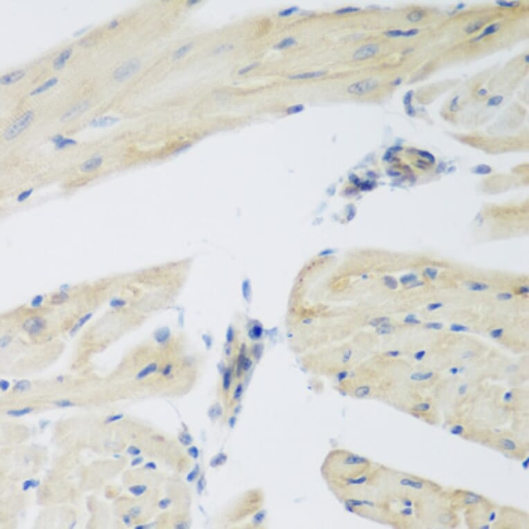 Immunohistochemistry - Anti-LEPREL2 Antibody (A2293) - Antibodies.com