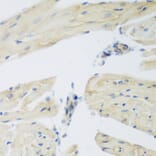 Immunohistochemistry - Anti-LEPREL2 Antibody (A2293) - Antibodies.com