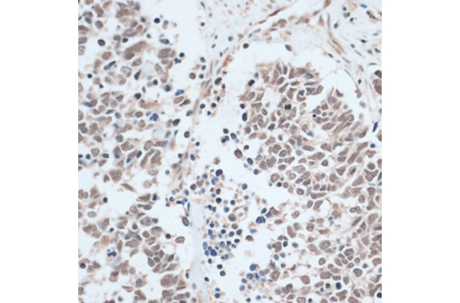 Immunohistochemistry - Anti-ZNF416 Antibody (A92435) - Antibodies.com