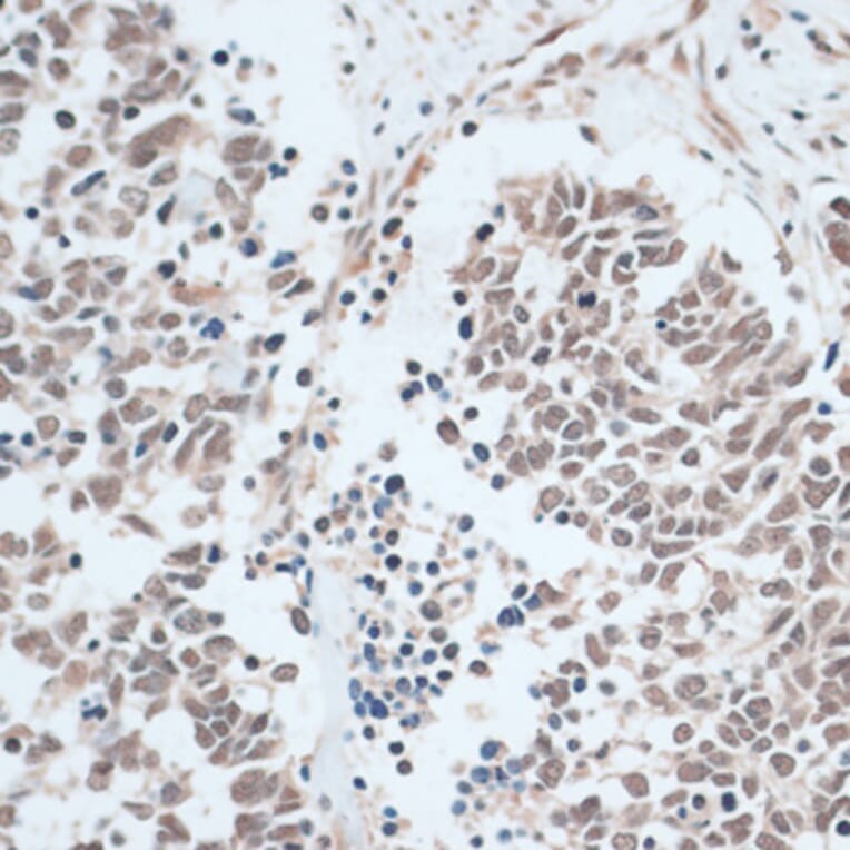 Immunohistochemistry - Anti-ZNF416 Antibody (A92435) - Antibodies.com