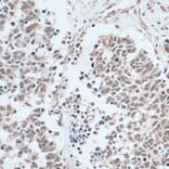 Immunohistochemistry - Anti-ZNF416 Antibody (A92435) - Antibodies.com