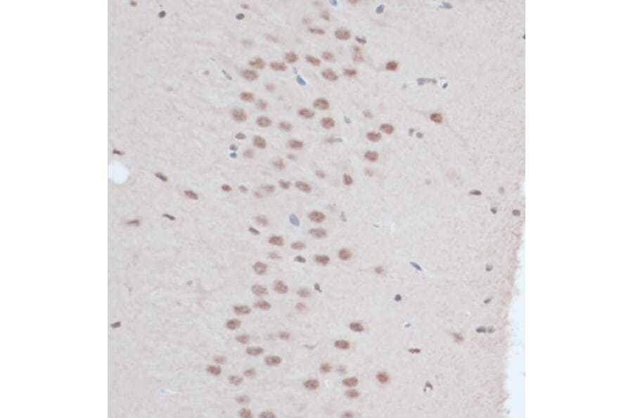 Immunohistochemistry - Anti-ZNF416 Antibody (A92435) - Antibodies.com