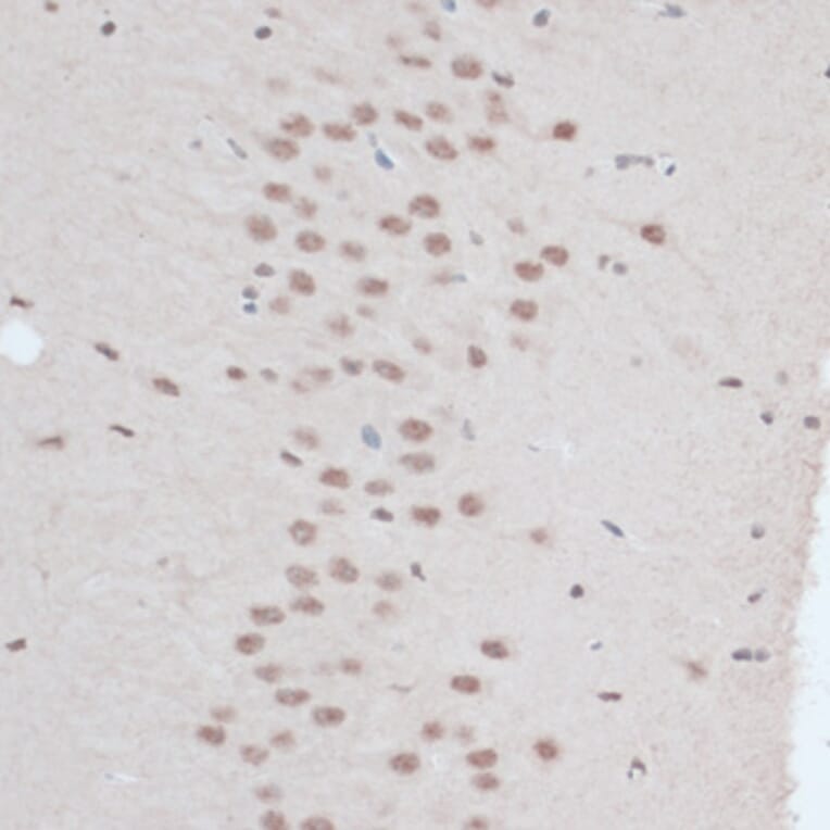 Immunohistochemistry - Anti-ZNF416 Antibody (A92435) - Antibodies.com