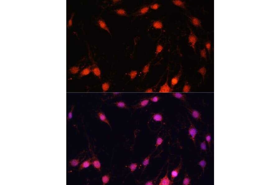 Immunofluorescence - Anti-ZNF416 Antibody (A92435) - Antibodies.com
