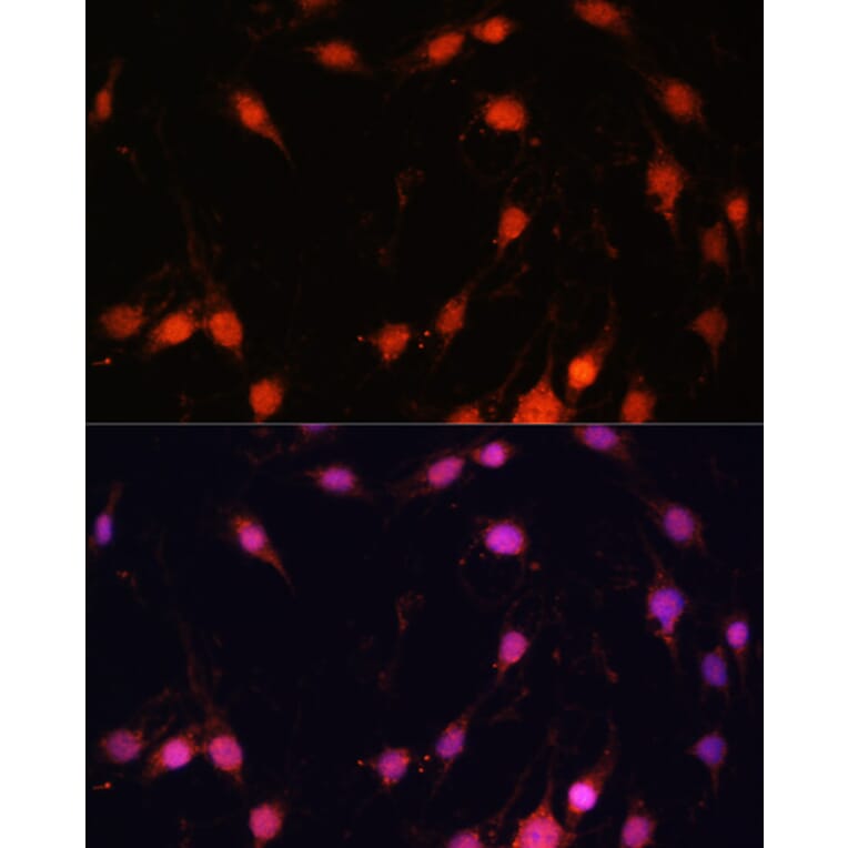 Immunofluorescence - Anti-ZNF416 Antibody (A92435) - Antibodies.com