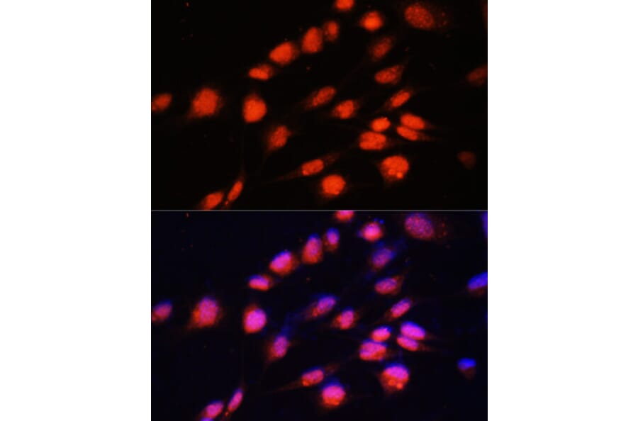 Immunofluorescence - Anti-ZNF416 Antibody (A92435) - Antibodies.com