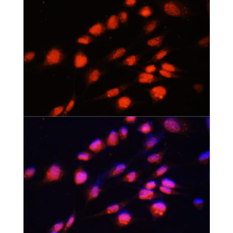 Immunofluorescence - Anti-ZNF416 Antibody (A92435) - Antibodies.com